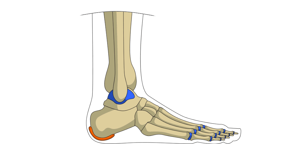 Injured Heel