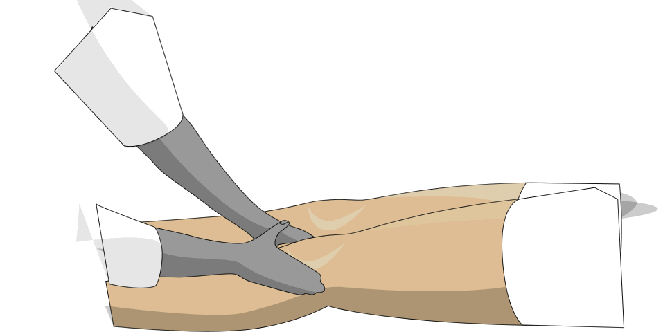 Sides of the Knee - Circular Friction Massage